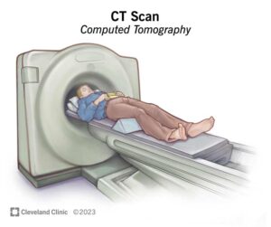 An image of ct scan which measures calcium score