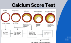 Image-of-calcium-score-test.png