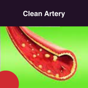 image showing clean artery